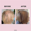 Women hair improvement using GLOWWA Hair Food - Australia's premier hair vitamin solution